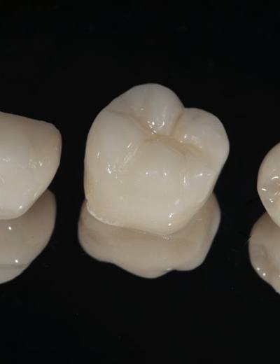 Three white dental crowns against black background