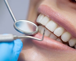 Close up of dental patient receiving scaling and root planing