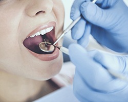 Emergency dentist in North Dallas performing an exam on a patient