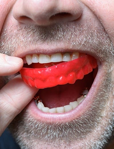 Man placing athletic mouthguard over his teeth