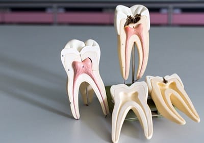 models of teeth on desk