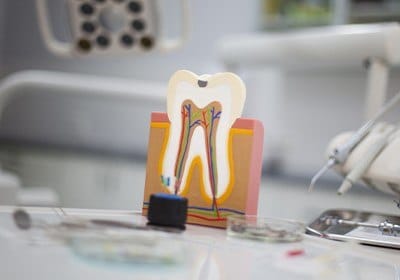 model of tooth on desk