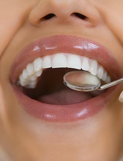 Close up of smile during dental treatment