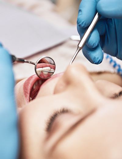 A dentist using a dental mirror and scraper to perform a dental exam