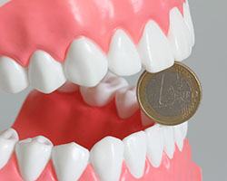 Pair of dentures biting down on a coin