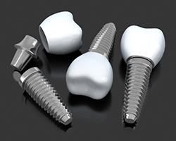 three dental implant posts with crowns and abutments