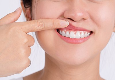 Woman showing off healthy gums
