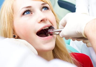 girl getting tooth extractions in North Dallas